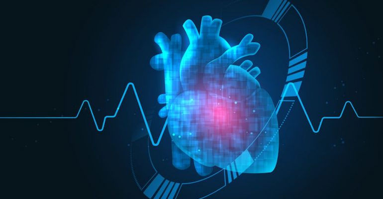 Angina pectoris (stabilna i nestabilna), kao i infarkt srčanog mišića su stadijumi koronarne bolesti koja je uzrokovana suženjem koronarnih arterija (koje krvlju snabdevaju srčani mišić).