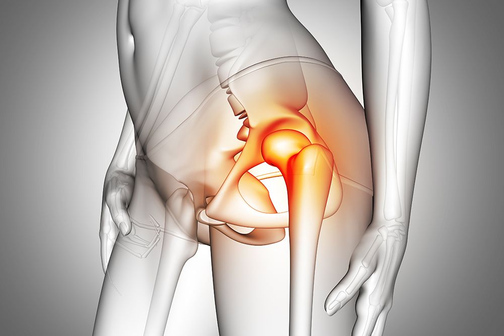osteoporoza kuka gimnastika za bolove u zglobu kuka