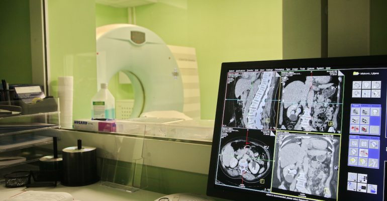 Multislajsna kompjuterizovana tomografija (MSCT) je vrhunska bezbolna i neivazivna dijagnostička metoda kojom se dobijaju vrlo precizni i kvalitetni prikazi različitih organa i delova ljudskog tela.