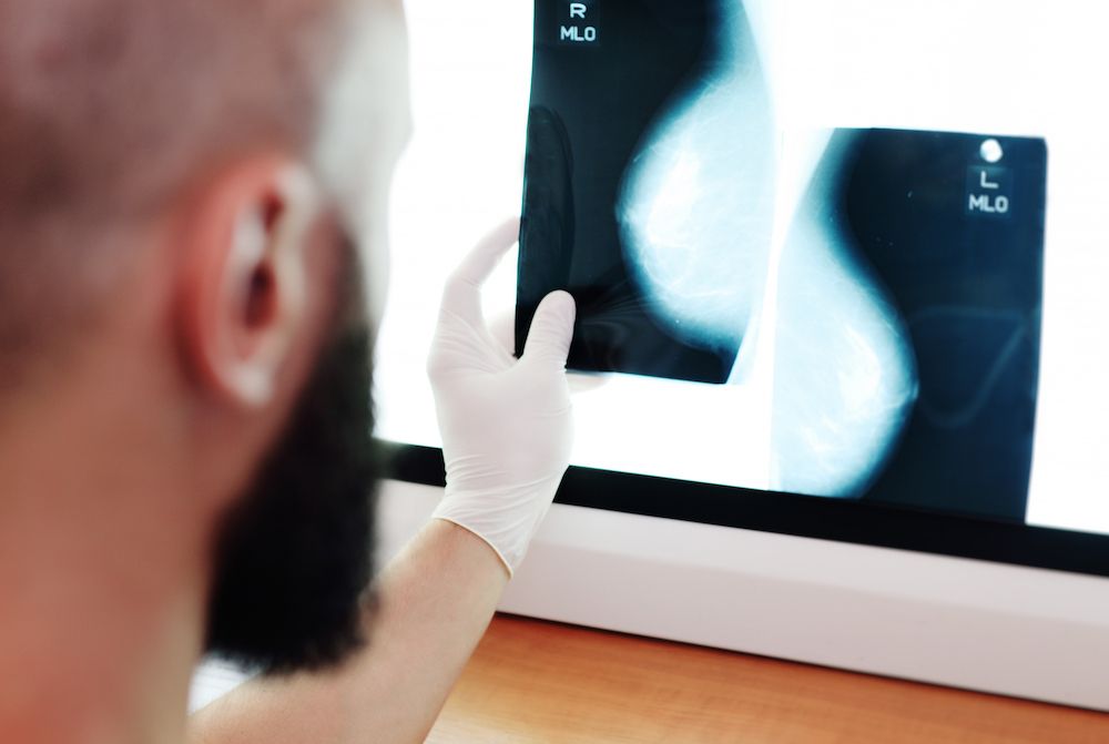 Mamografija je bezbolna, RTG metoda, za ispitivanje dojki. Prvu mamograifju treba uraditi oko 40. godine života, a kasnije po preporuci lekara.