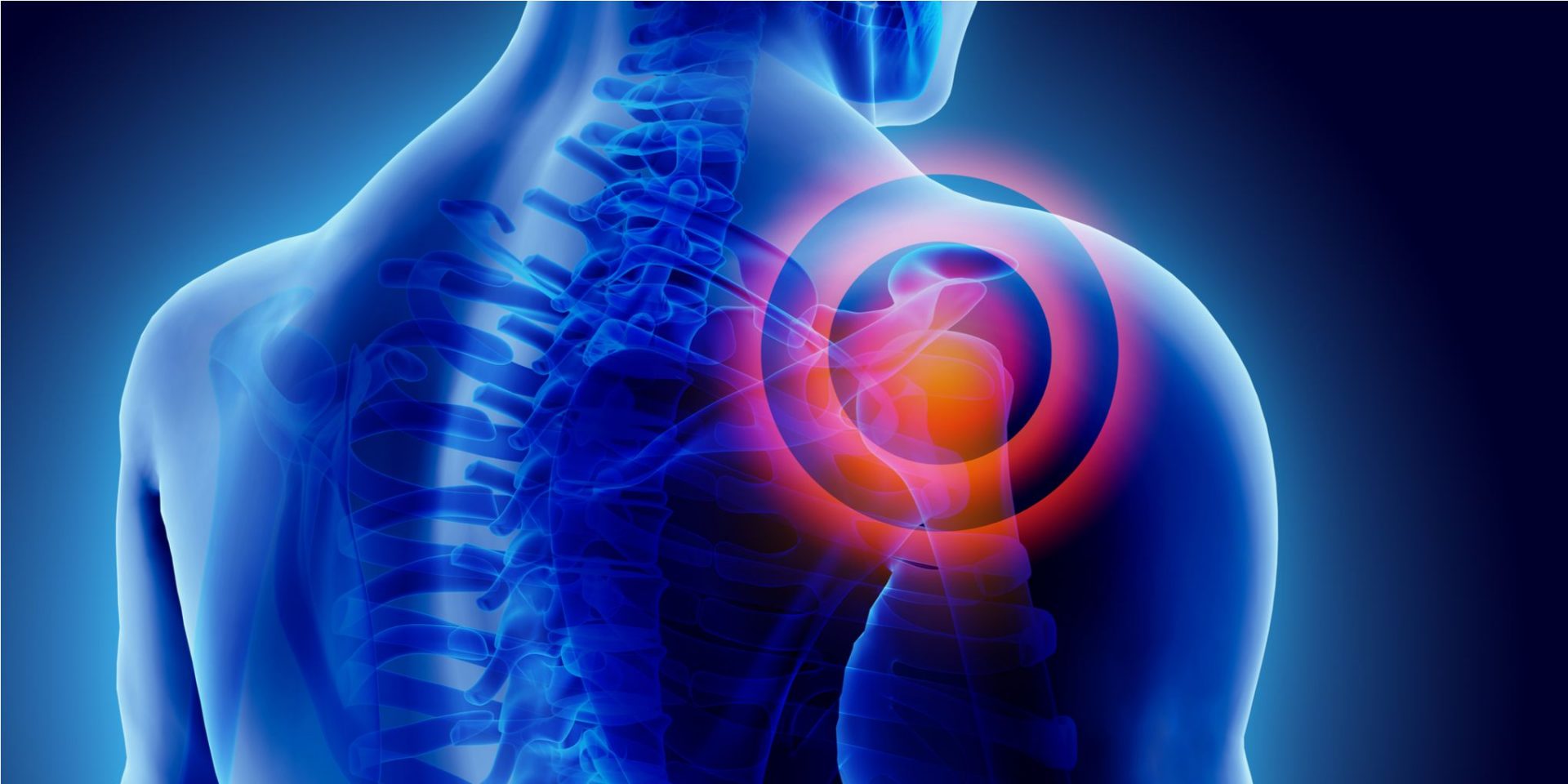 Bolna ramena i rameni zglobovi - kako ukloniti bol? Dijagnostika i vježbe za liječenje